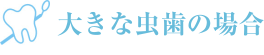 大きな虫歯の場合