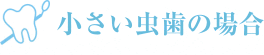 小さい虫歯の場合
